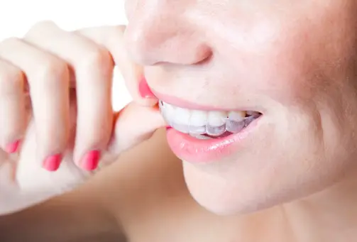 The Invisible Way to a Straighter Smile: Sure Smiles Clear Aligners in Buda, TX